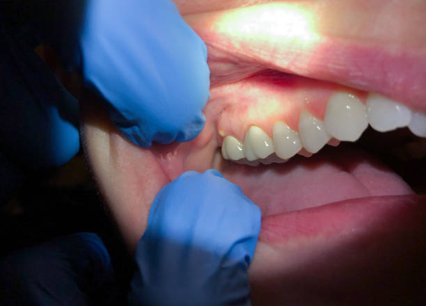 Best Emergency TMJ Treatment in Coldstream, OH